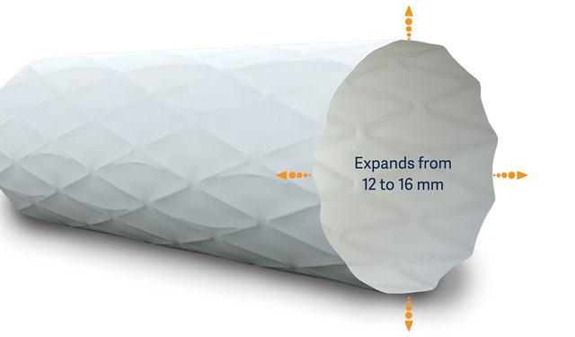Ein weißer, zylindrischer medizinischer Stent mit strukturierter Oberfläche und der Aufschrift „Dehnt sich von 12 auf 16 mm aus“ und orangefarbenen Pfeilen.