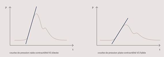 Left Ventricular Contractility Left Ventricular Contractility