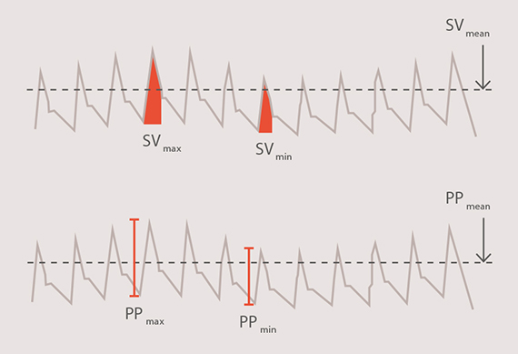 Volume responsiveness graph Volume responsiveness graph