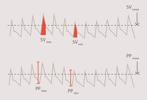 Volume responsiveness graph