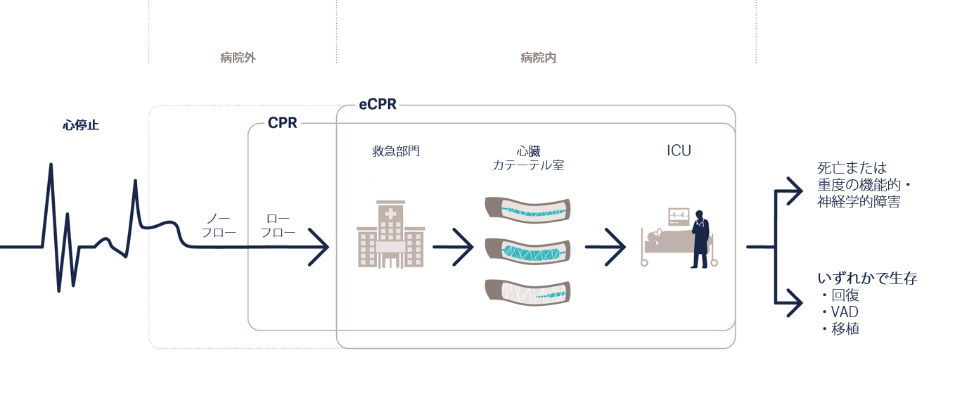 get22121_graph_ECMO_Insight_R03_1280_eCPR_JP.png