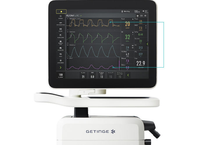 Getinge Servo ventilator monitoring techniques Getinge Servo ventilator monitoring techniques