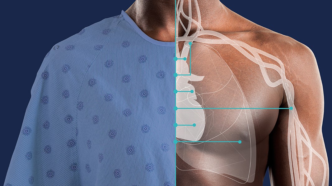 Get the complete picture on hemodynamic parameter Advanced Hemodynamic Monitoring