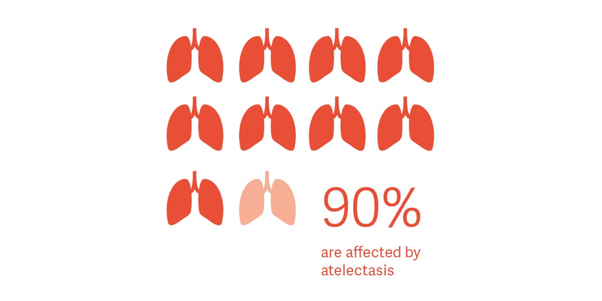 Atelectasies Atelectasies