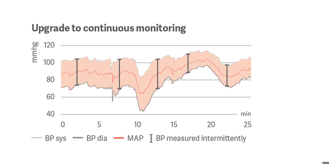 Upgrade to continuous monitoring