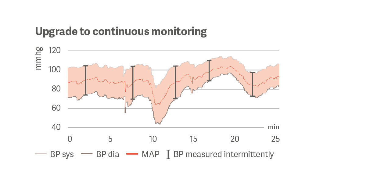Upgrade to continuous monitoring Upgrade to continuous monitoring