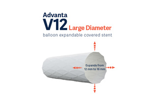 Illustration of an Advanta V12 large diameter stent, expandable from 12mm to 16mm.