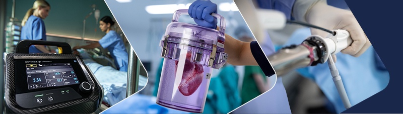 innovative Lösungen für die Herzchirurgie und extrakorporale Unterstützung