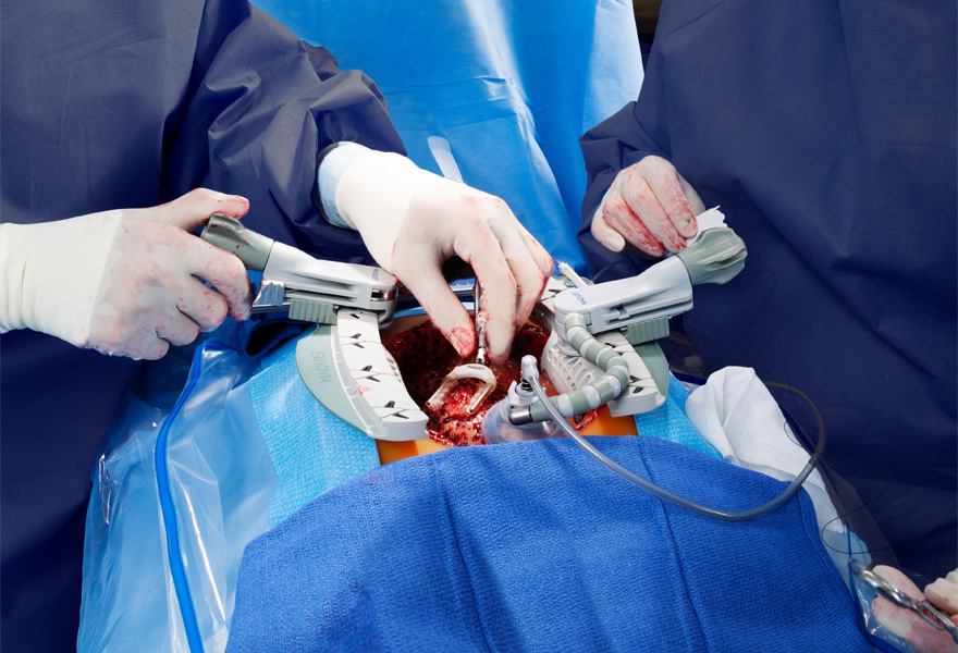 Maquet magnus beating heart surgery Maquet magnus beating heart surgery
