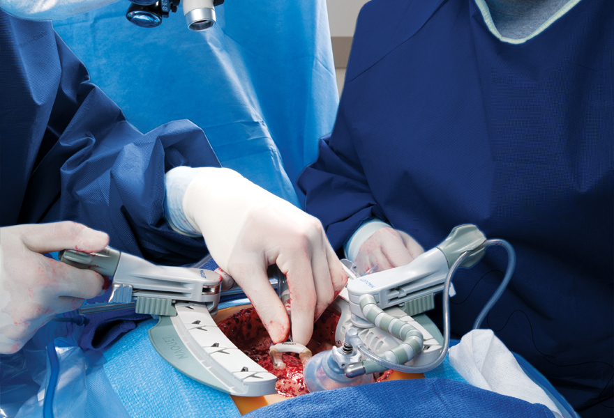 Maquet Magnus beating heart surgery Maquet Magnus beating heart surgery