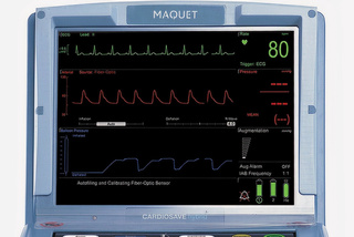 Close up of Cardiosave monitor showing patient blood trends
