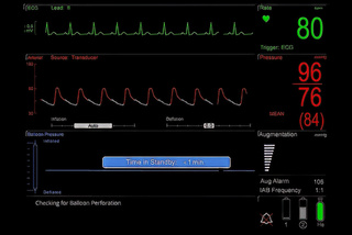 Cardiosave blood surveillance algorithm monitor close up