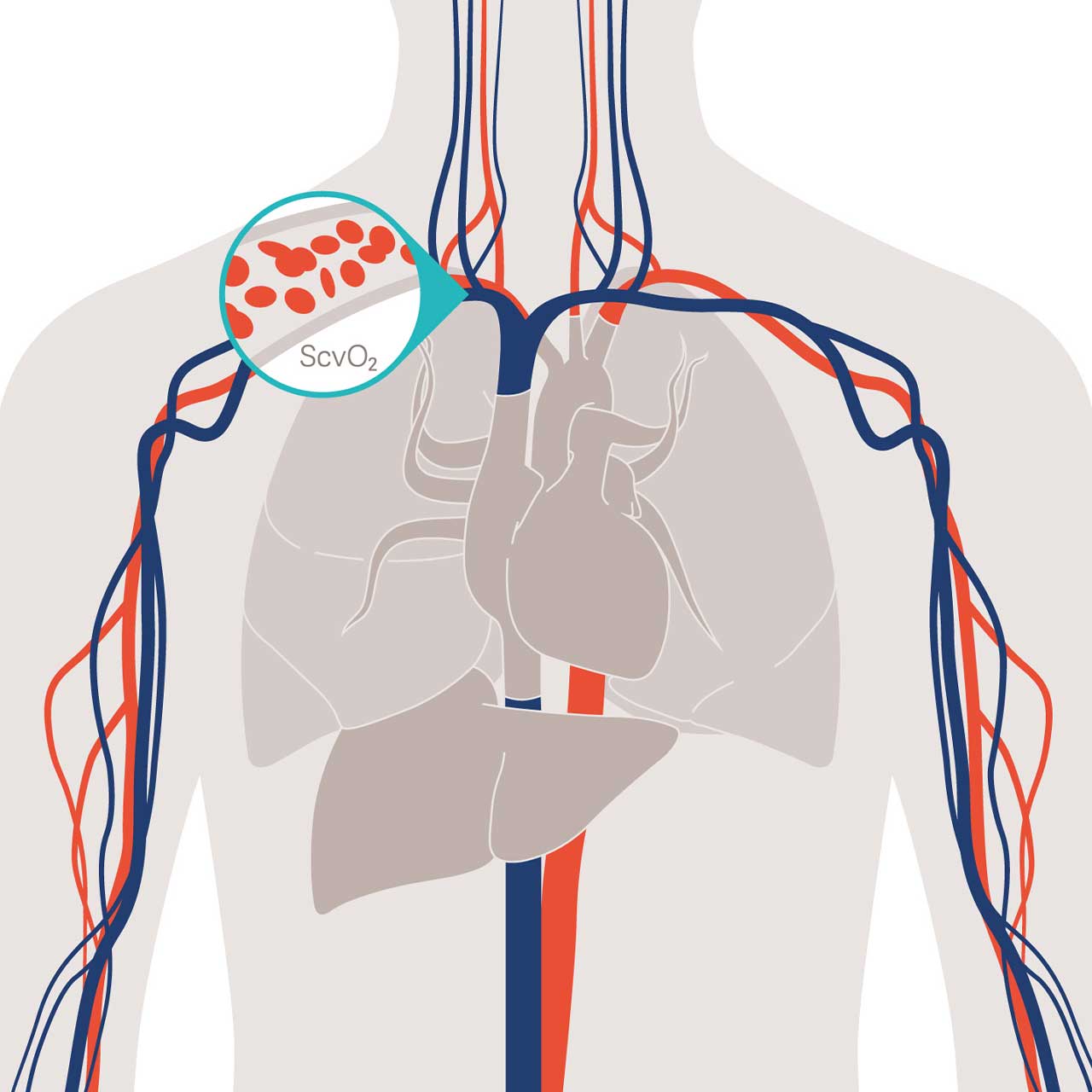 CeVOX detects acute changes in systemic balance between  oxygen delivery and consumption