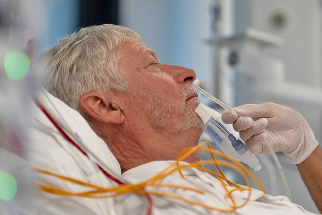 Close up of sedated adult male patient with Edi ENFit catheter being inserted into nose.