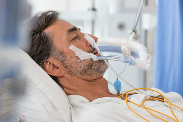 Close up of intubated and sedated adult male patient with Edi ENFit cather in nose.