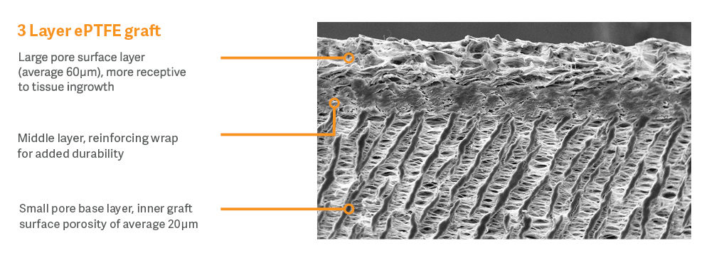 3 Layer ePTFE image with labels