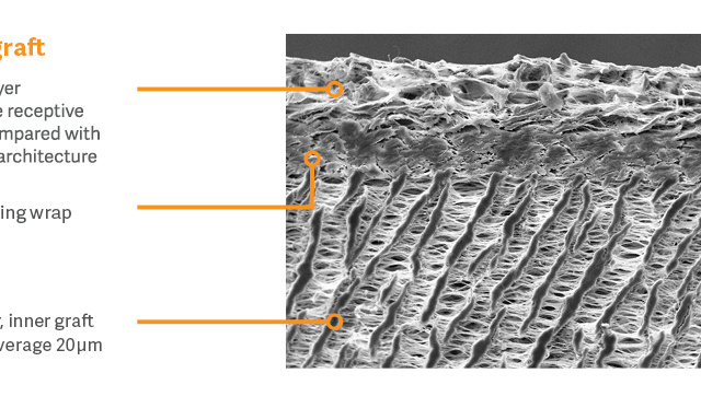 3 Layer ePTFE image with labels