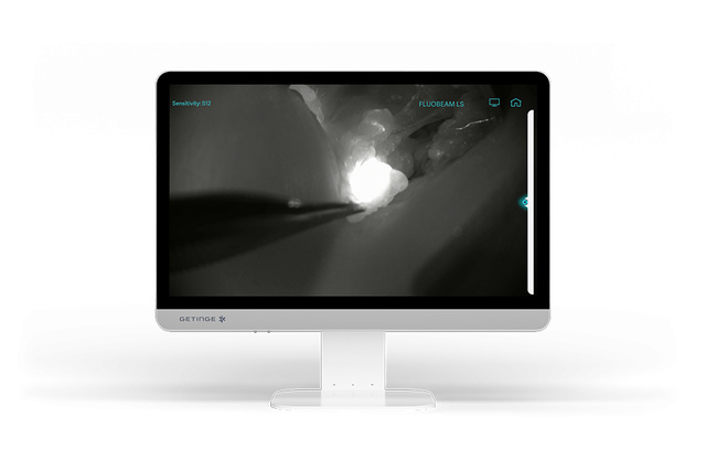 Getinge fluobeam ls, fluorescence imaging device, fluorescence camera, autofluorescence camera, fluoptics camera,sentinel-lymph-node-identification