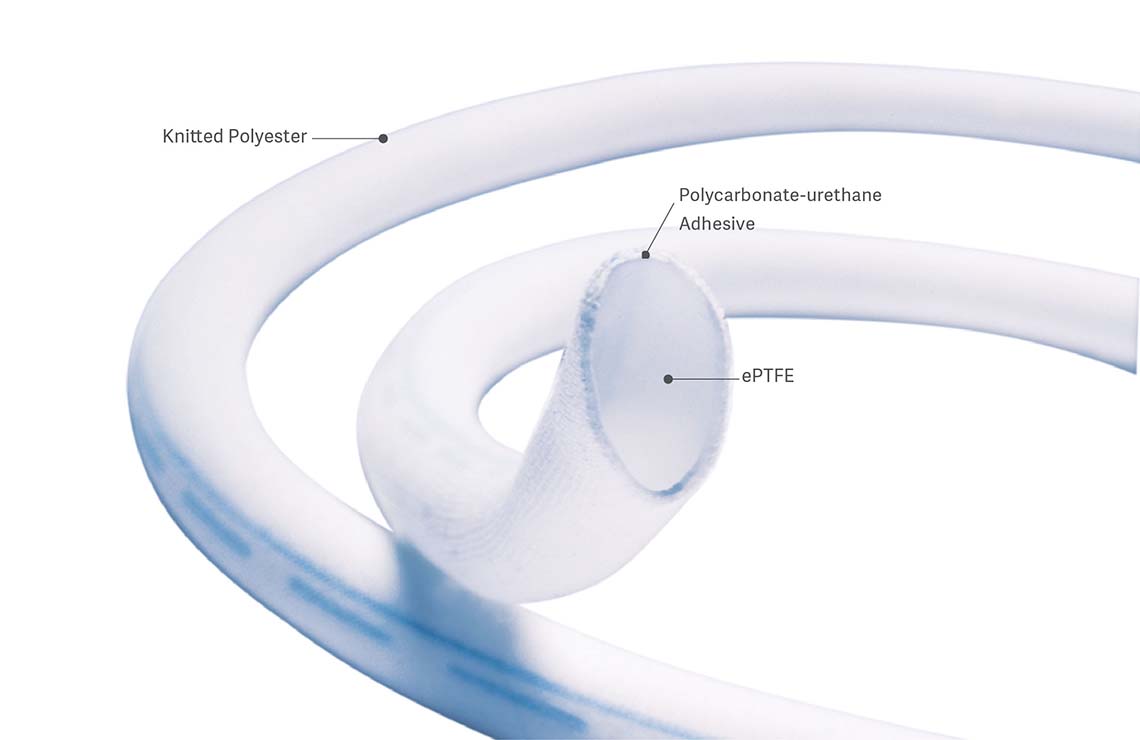The ePTFE inner layer of Getinges Fusion vascular graft is designed to offer long-term patency rates similar to standard ePTFE vascular grafts