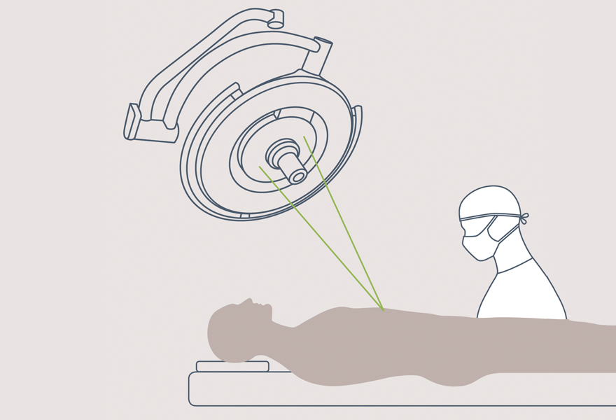 Maquet PowerLED II surgical light laser positioning guide