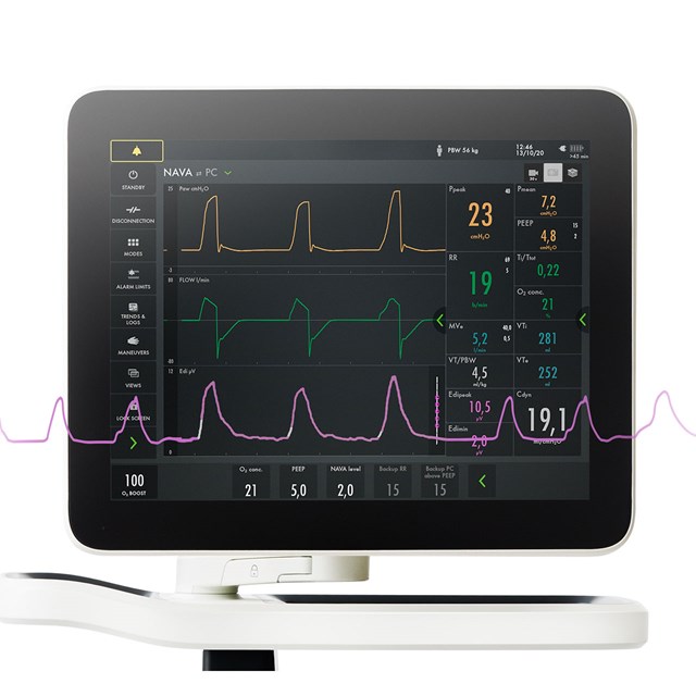 Getinge Servo-u mechanical ventilator screen showing monitoring of the patient`s Edi signal thevital sign of respiration