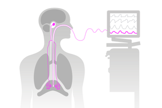 Diagram of a human silhouette showing a tube connected from the nose to a monitor, indicating internal monitoring.