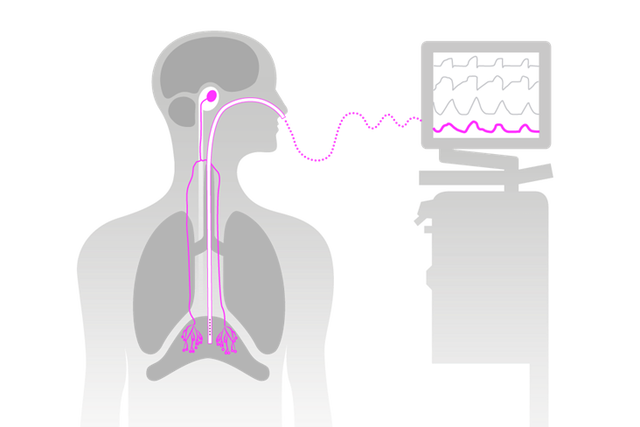 Diagram of a human silhouette showing a tube connected from the nose to a monitor, indicating internal monitoring.