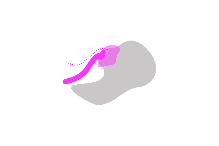 Illustation non-invasive nava Illustation non-invasive nava