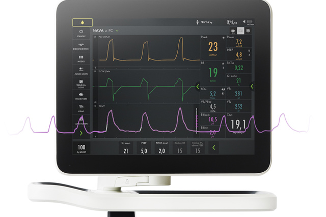 Servo-u ventialtor NAVA with EDI curve graphic