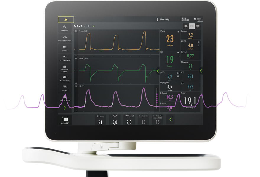 Servo-u ventialtor NAVA with EDI curve graphic