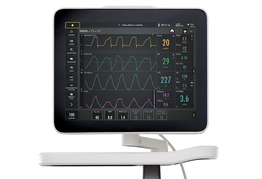 Servo screen edi signal