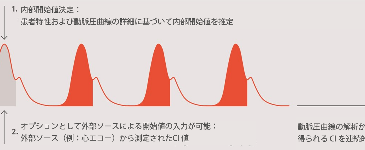 ProAQT 心拍出量測定モニタリングの仕組み