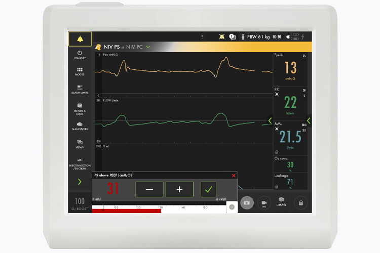 Servo-air niv safety scale parameters