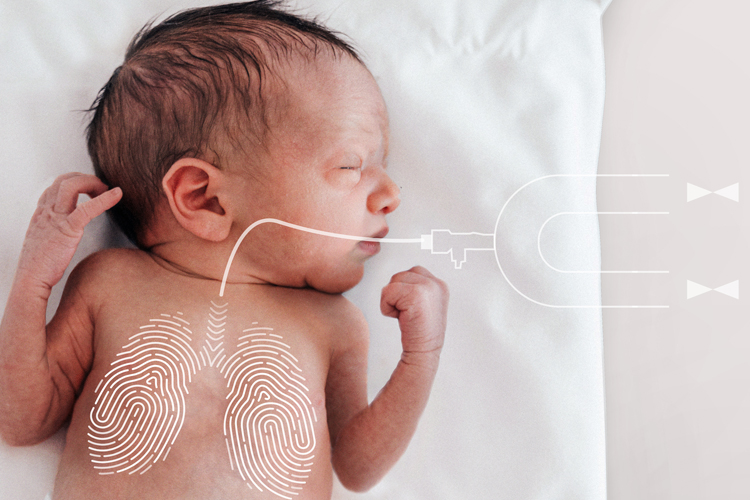 Neonate, HFOV, high frequency oscillation, work of breathing, high flow capacity, apnea, neonatal Neonate, HFOV, high frequency oscillation, work of breathing, high flow capacity, apnea, neonatal