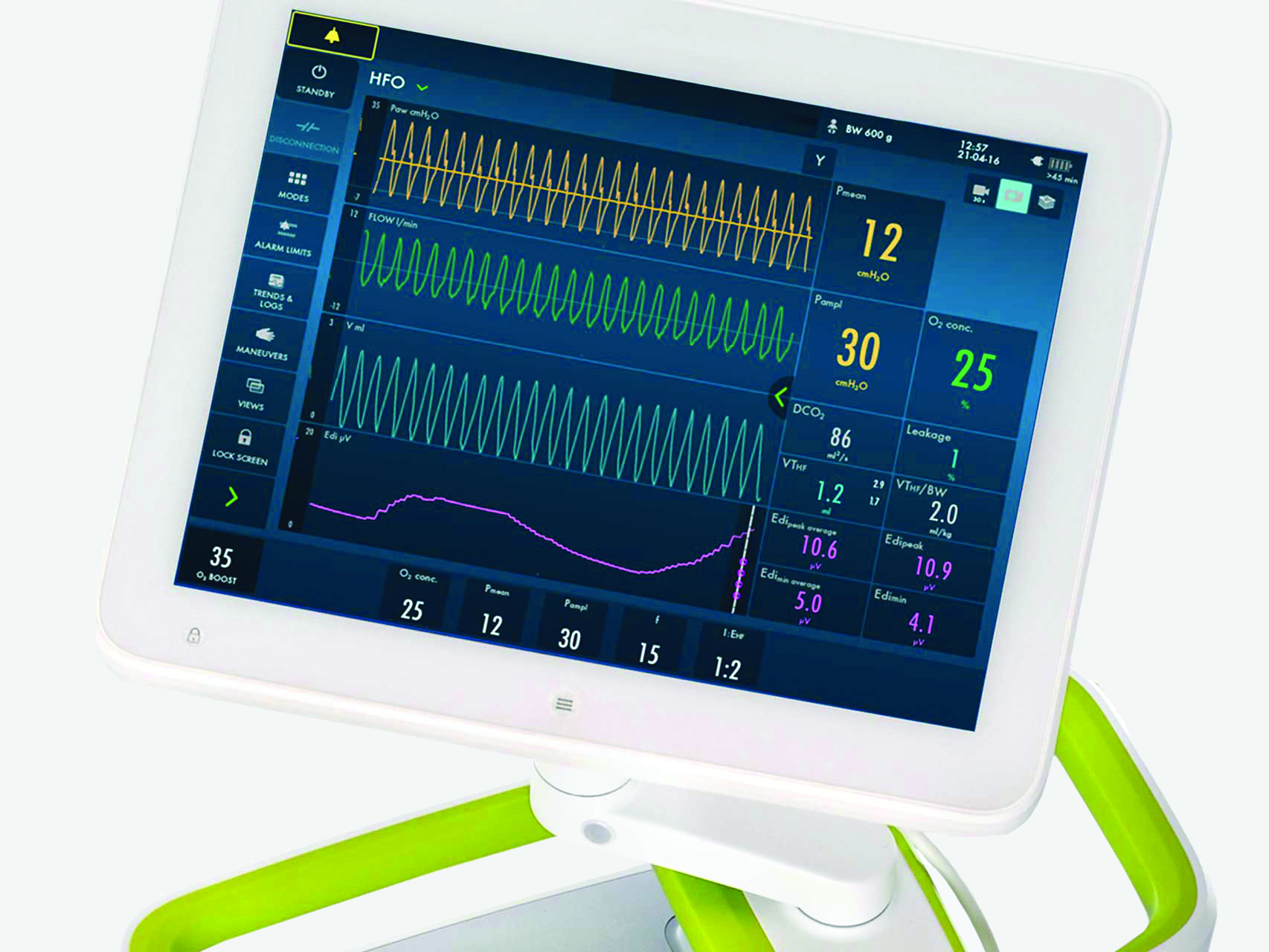 Getinge Servo-n mechanical ventilator screen showing HFOV High Frequency Oscillatory Ventilation ventilation mode