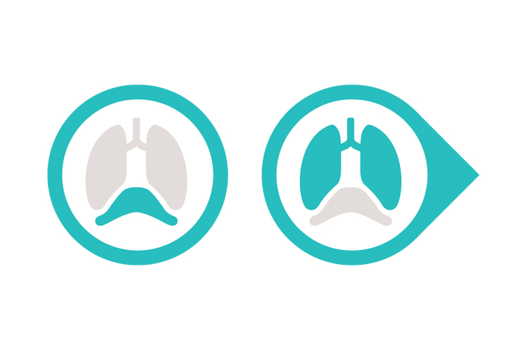 Getinge Servou® the simple to use safer to learn mechanical ventilator