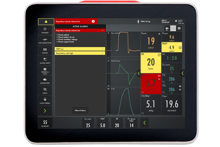 Getinge Servou® the simple to use safer to learn mechanical ventilator