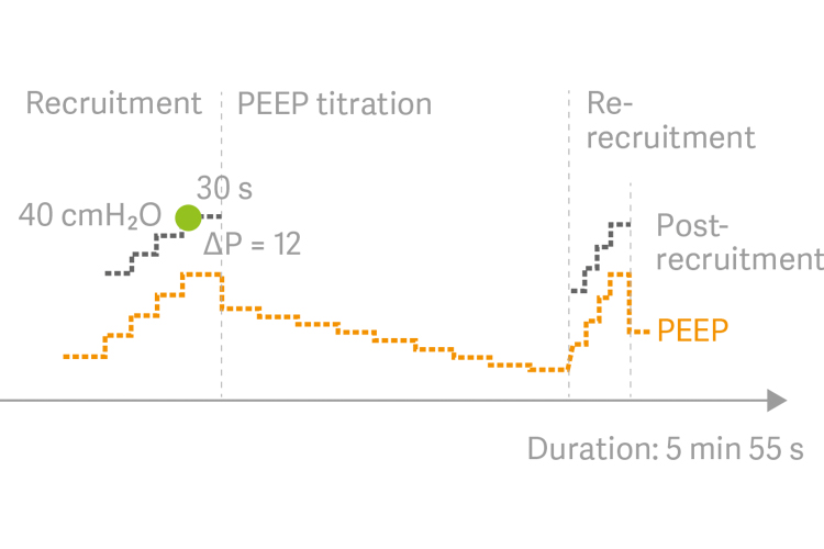 Automatic recruitment maneuvers