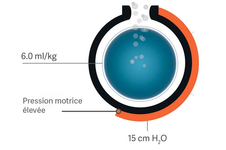 Getinge Servou® le ventilateur mécanique facile à utiliser et le