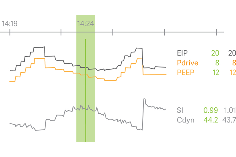 Getinge Servou® the simple to use safer to learn mechanical ventilator
