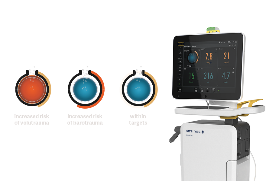 Servo Compass mechanical ventilation