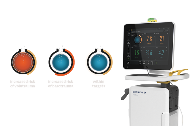 Servo Compass mechanical ventilation