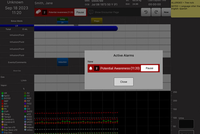 Screen showing Talis Anesthesia Cockpit with Modal