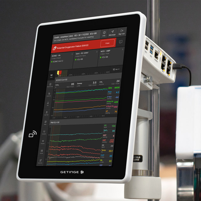 Close up of Talis ECMOView on bedside monitor