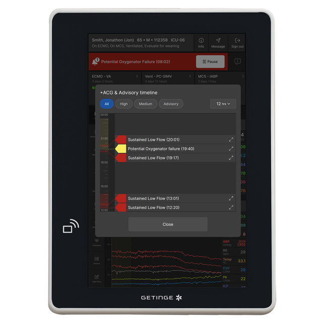 Talis ECMOView screen