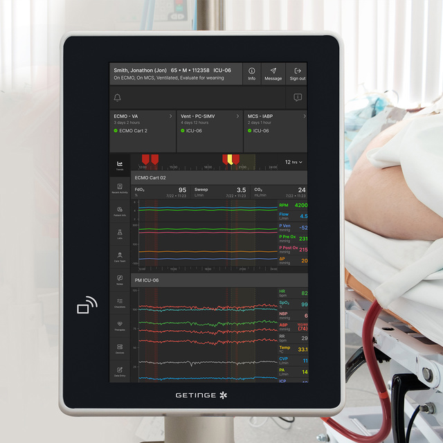 Close up of Talis ECMOView on bedside monitor