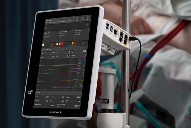 Close up of Talis ECMOView on bedside monitor