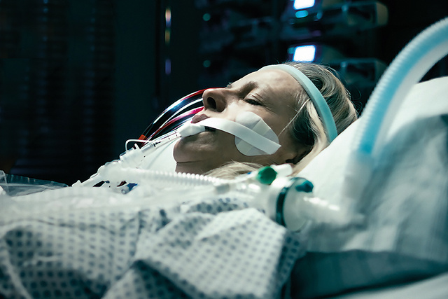 Sleeping ECMO patient in ICU bed