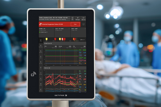 Close up of Talis ECMOView on bedside monitor
