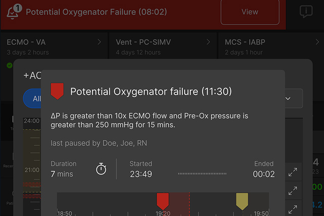 Talis ECMOView close up screen showing +ACG alert.